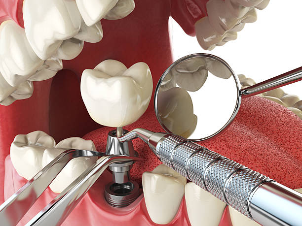 Best Weekend Emergency Dentist in Millersport, OH